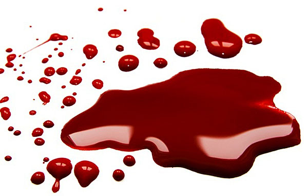 Resultado de imagem para manchas de sangue