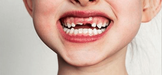 Featured image of post Significado De Sonhar Com Dente Quebrado Caindo quebrado podre e ou dente mole