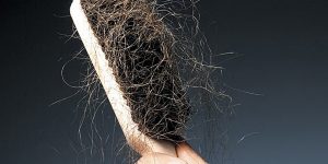 cabelo caindo