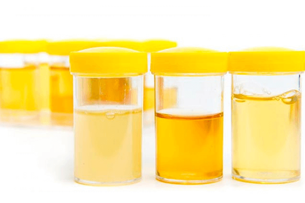 Sonhar com urina: quais são os significados?