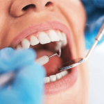 Sonhar com dentista: quais são os significados?