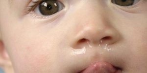 Sonhar com catarro