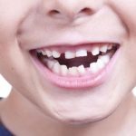 Sonhar com dente torto – O que significa? Respostas, aqui!